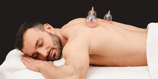 Cupping Therapy